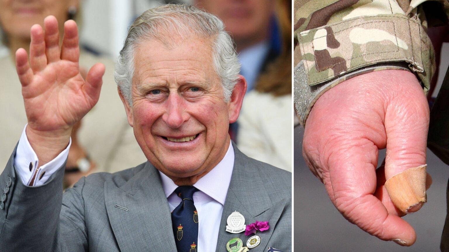 prince charles fingers